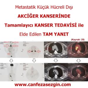 Tedavilere Dirençli Kanser Kök Hücreleri Nasıl Öldürülür?