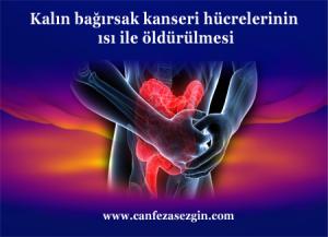 Kalın Bağırsak Kanseri Hücrelerinin Isı ile Öldürülmesi