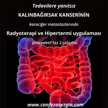 Tedavilere Yanıtsız Kalınbağırsak Kanserinin Karaciğer Metastazlarında Radyoterapi ve Hipertermi Uygulaması: Prospektif Faz 2 Çalışma