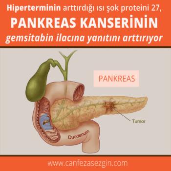 Hiperterminin Artırdığı Isı Şok Proteini 27, Pankreas Kanserinin Gemsitabin İlacına Yanıtını Artırıyor