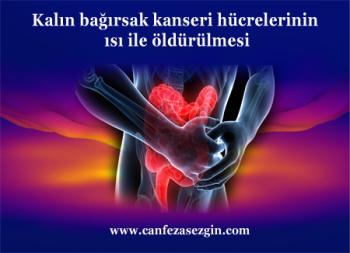 Kalın Bağırsak Kanseri Hücrelerinin Isı ile Öldürülmesi