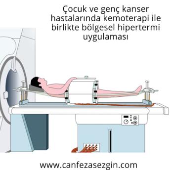 Çocuk Ve Genç Kanser Hastalarında Kemoterapi İle Birlikte Bölgesel Hipertermi Uygulaması