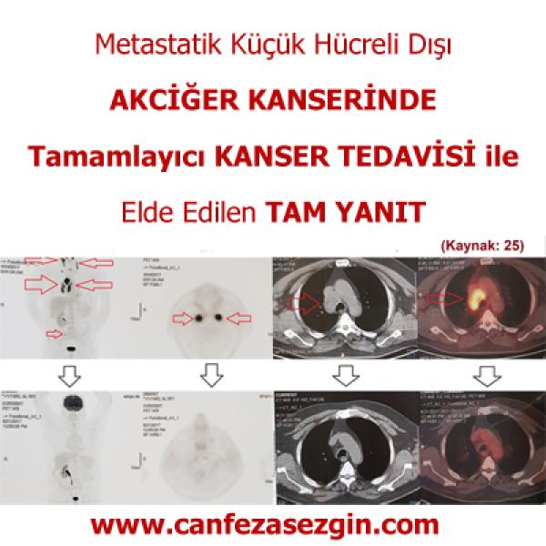 Tedavilere Dirençli Kanser Kök Hücreleri Nasıl Öldürülür?