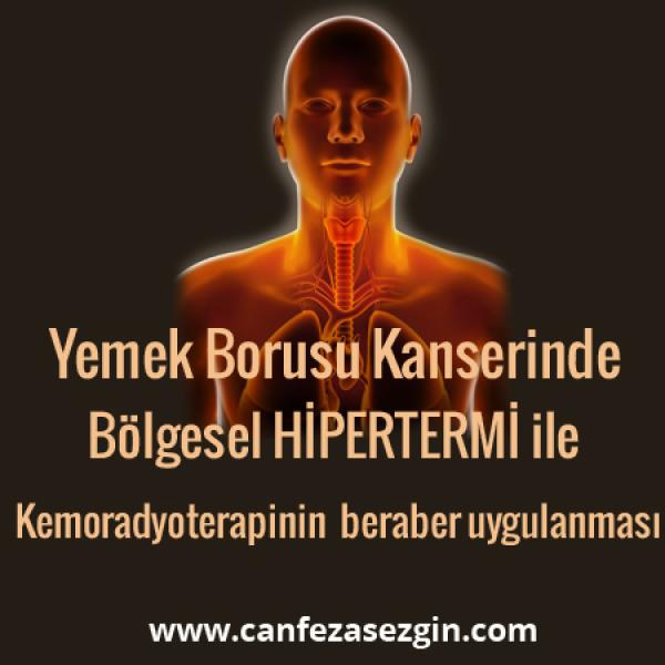 Yemek Borusu Kanserinde Bölgesel Hipertermi ile Kemoradyoterapinin Beraber Uygulanması