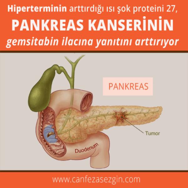 Hiperterminin Artırdığı Isı Şok Proteini 27, Pankreas Kanserinin Gemsitabin İlacına Yanıtını Artırıyor
