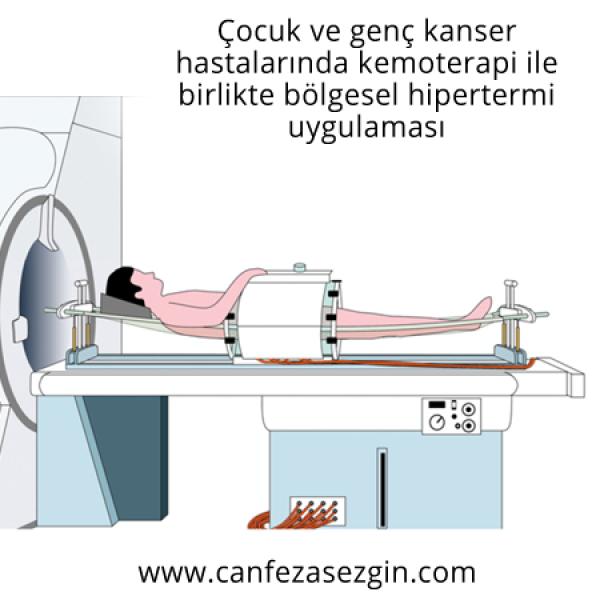Çocuk Ve Genç Kanser Hastalarında Kemoterapi İle Birlikte Bölgesel Hipertermi Uygulaması