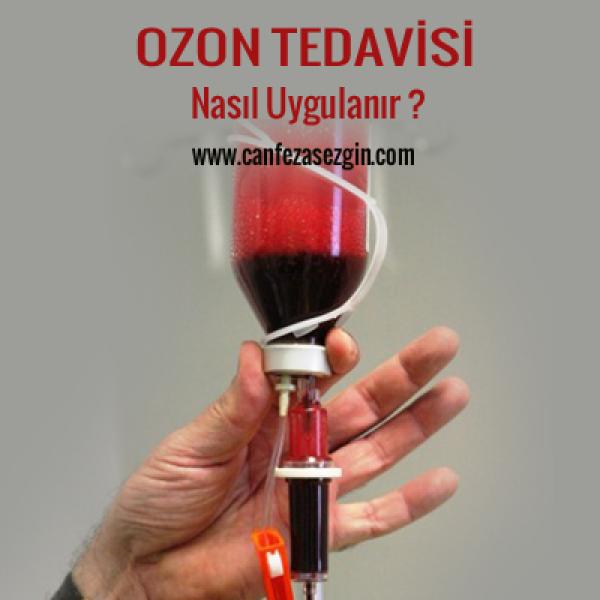 Ozon Tedavisi Nasıl Uygulanır?