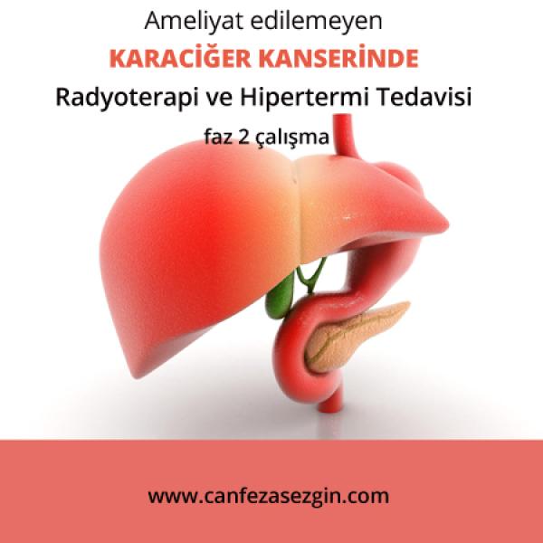Ameliyat Edilemeyen Karaciğer Kanserinde Radyoterapi ve Hipertermi Tedavisi Faz 2 Çalışma